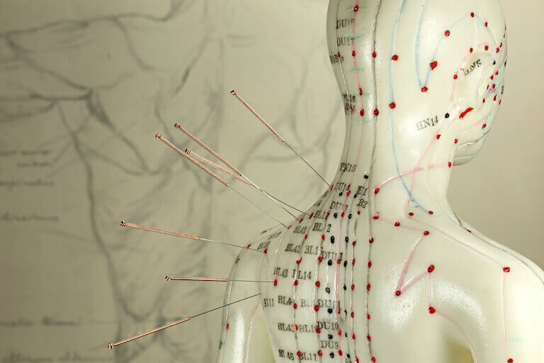 A miniature model of the human body shows chi energy channels, with acupuncture needles in some of them.